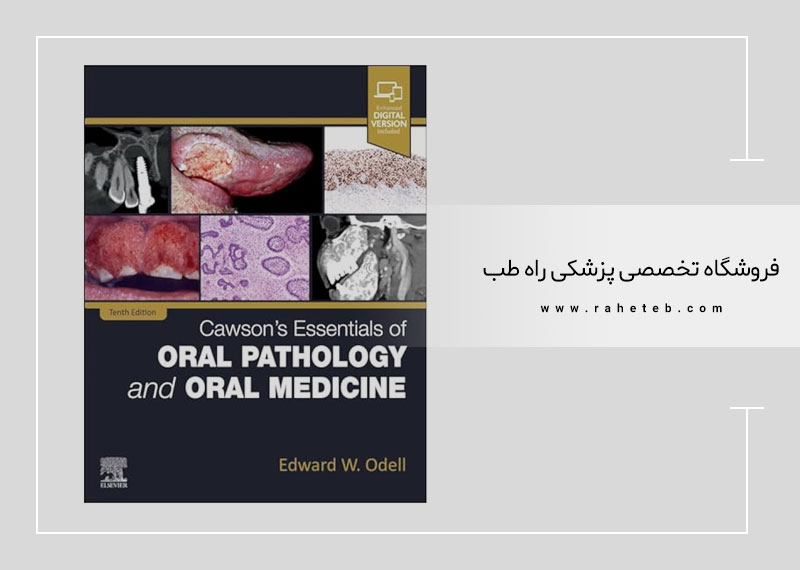 Essentials of Oral Pathology and Oral Medicine – Edward Odell