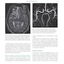 Diagnostic Imaging Armstrong 7th Edicion  2013