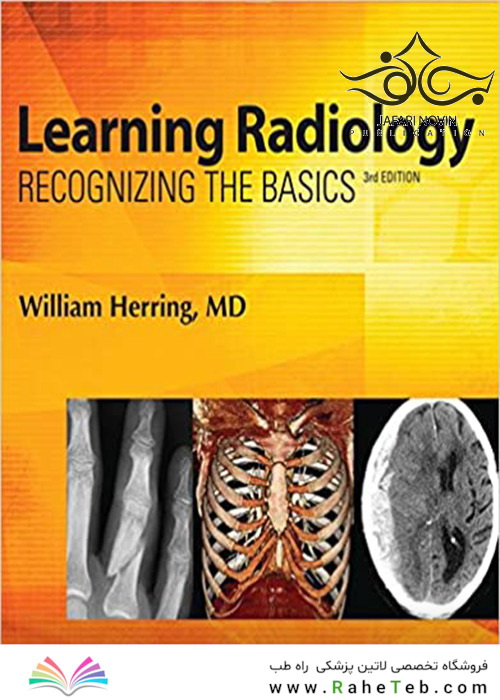 Learning Radiology: Recognizing the Basics