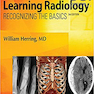 Learning Radiology: Recognizing the Basics