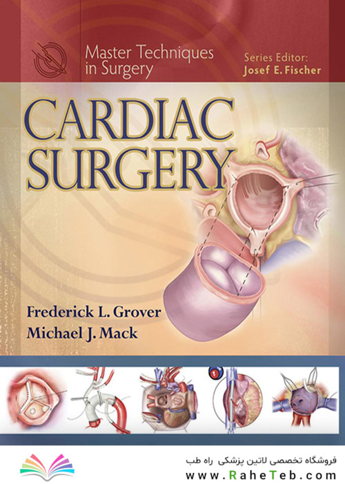 Cardiac Surgery (Master Techniques in Surgery)