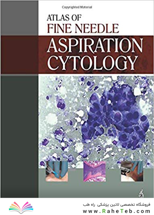 کتاب Atlas of Fine Needle Aspiration Cytology