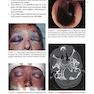 Atlas of Emergency Medicine (اطلس اورژانس پزشکی)