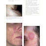 Skin Disease: Diagnosis and Treatment 4th Edition 2018