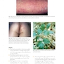 Skin Disease: Diagnosis and Treatment 4th Edition 2018