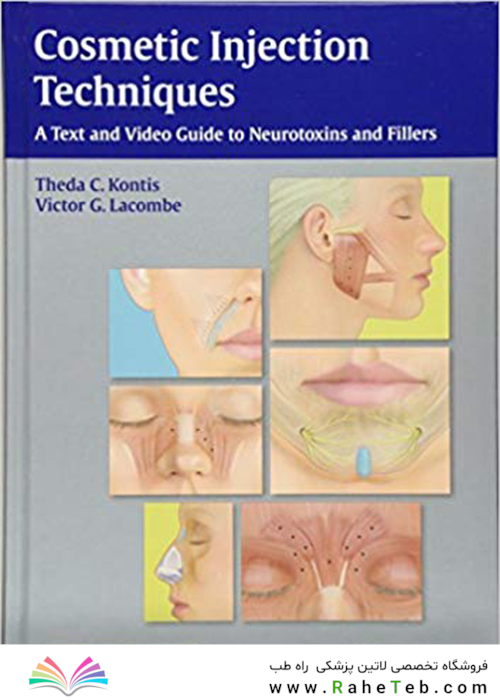 Cosmetic Injection Techniques