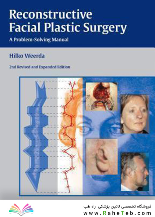 Reconstructive Facial Plastic Surgery : A Problem-Solving Manual