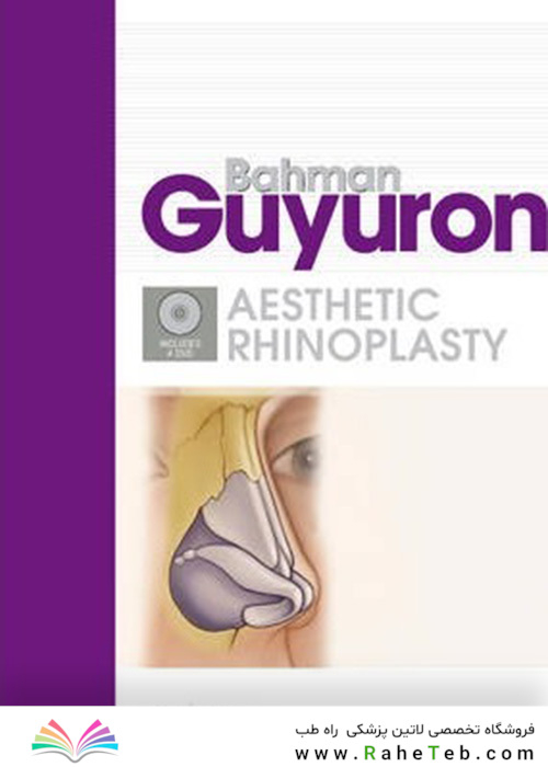 Rhinoplasty