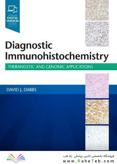 Diagnostic Immunohistochemistry : Theranostic and Genomic Applications