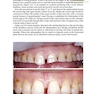 Practical Procedures in Aesthetic Dentistry