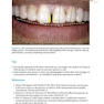 Practical Procedures in Aesthetic Dentistry