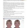 Practical Procedures in Aesthetic Dentistry
