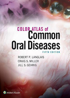 عکس Color Atlas of Common Oral Diseases
