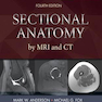Sectional Anatomy by MRI and CT