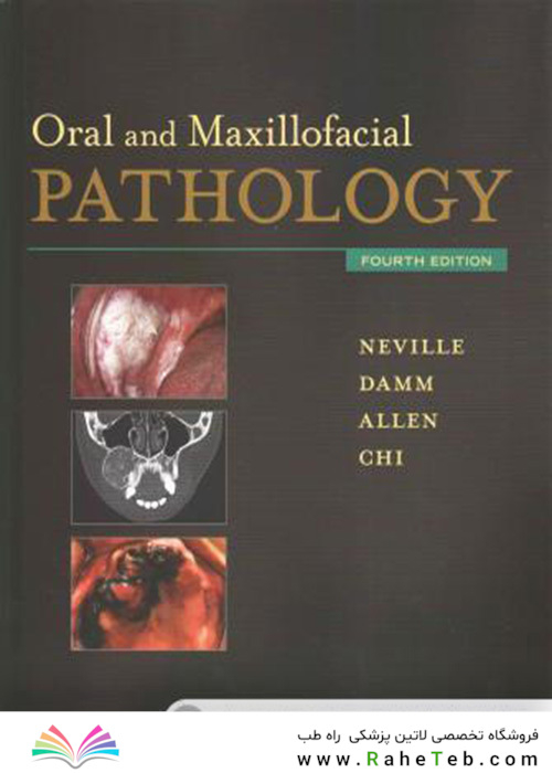 Oral and Maxillofacial Pathology