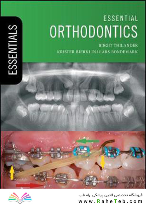 Essential Orthodontics