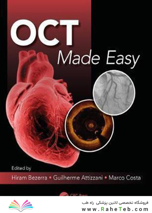 OCT Made Easy