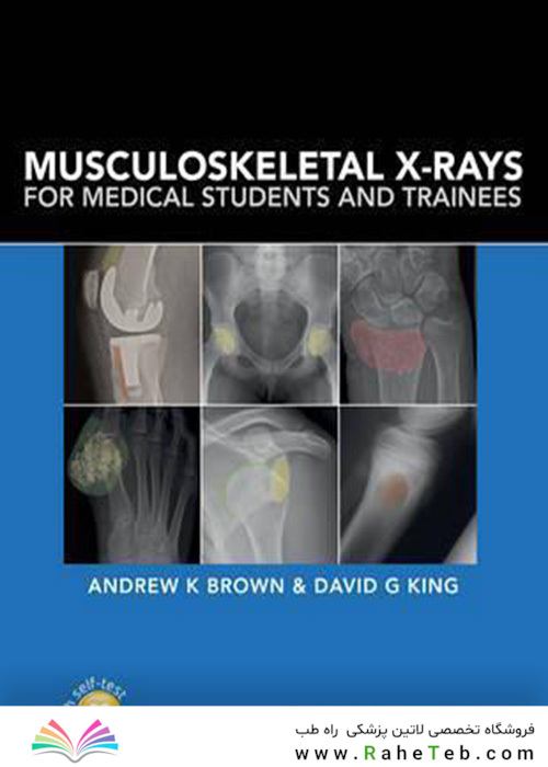 Musculoskeletal X-Rays for Medical Students and Trainees