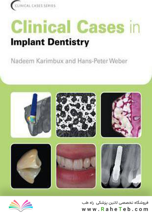Clinical Cases in Implant Dentistry