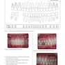 Clinical Cases in Implant Dentistry