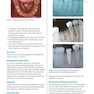 Clinical Cases in Implant Dentistry