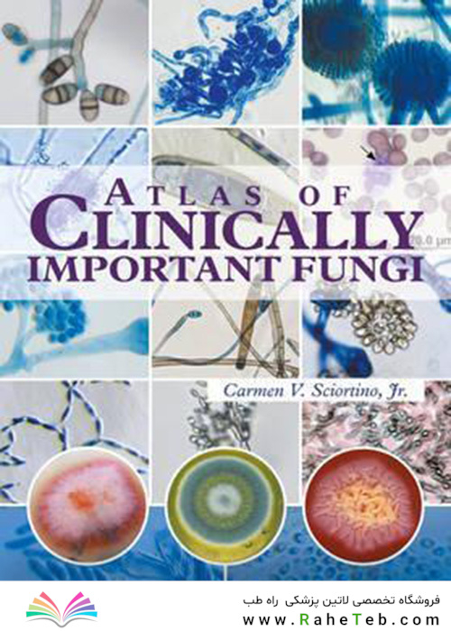 Atlas of Clinically Important Fungi2017