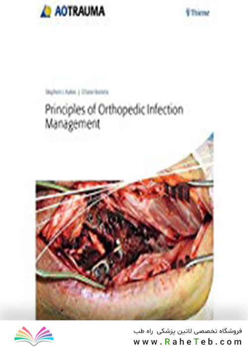 Principles of Orthopedic Infection Management