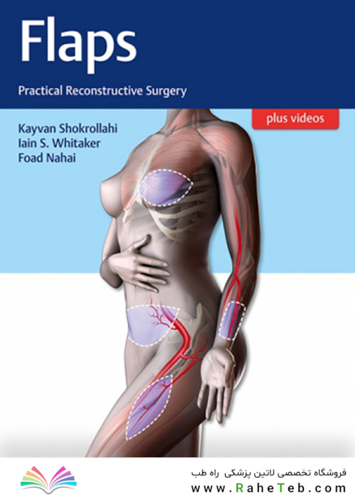 Flaps : Practical Reconstructive Surgery