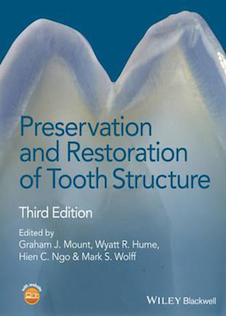 عکس Preservation and Restoration of Tooth Structure 2016 حفظ و ترمیم ساختار دندان