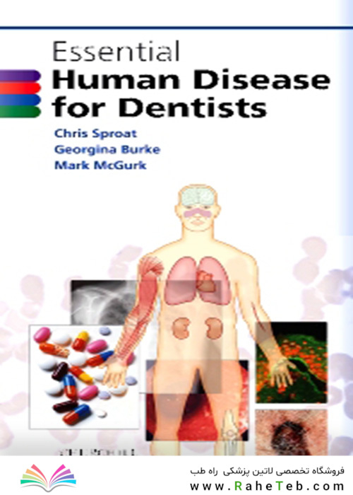 Essential Human Disease for Dentists 