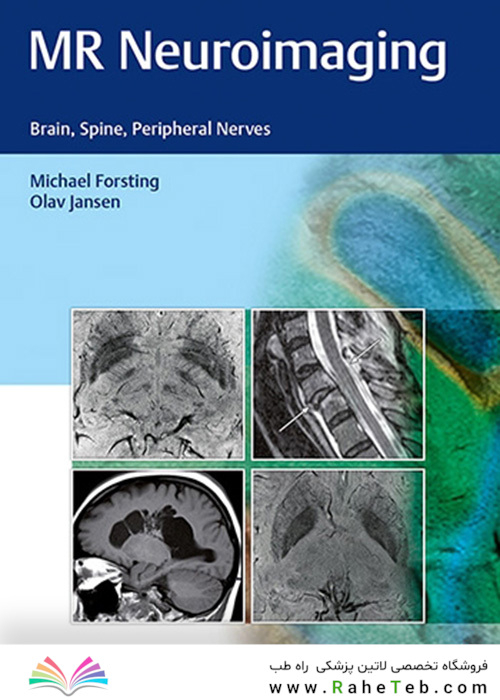 MR Neuroimaging : Brain, Spine, and Peripheral Nerves