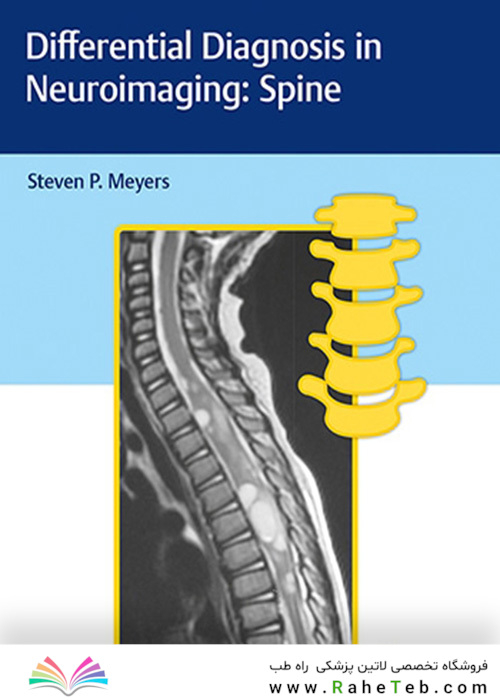 Differential Diagnosis in Neuroimaging: Spine 1st Edición