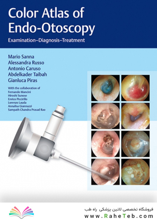 Color Atlas of Endo-Otoscopy : Examination-Diagnosis-Treatment
