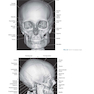 Sectional Anatomy for Imaging Professionals