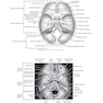 Sectional Anatomy for Imaging Professionals