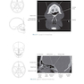 Sectional Anatomy for Imaging Professionals