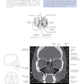 Sectional Anatomy for Imaging Professionals