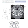 Sectional Anatomy for Imaging Professionals