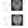 Sectional Anatomy for Imaging Professionals