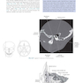 Sectional Anatomy for Imaging Professionals