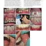 Lasers in Dentistry-Current Concepts