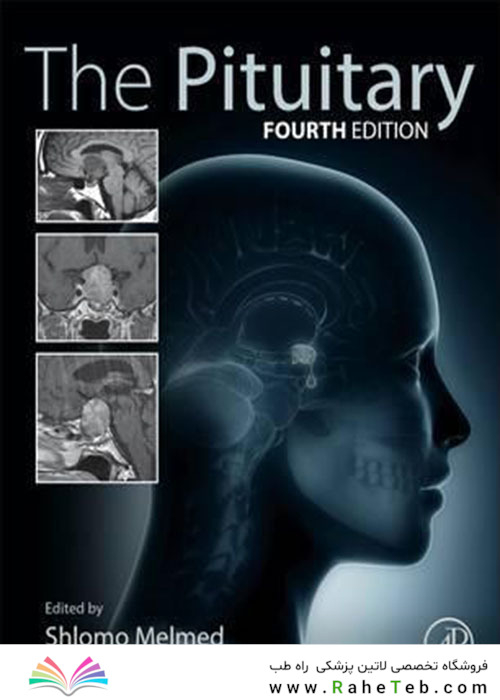 The Pituitary