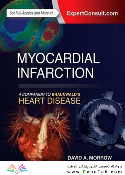 Myocardial Infarction: A Companion to Braunwald