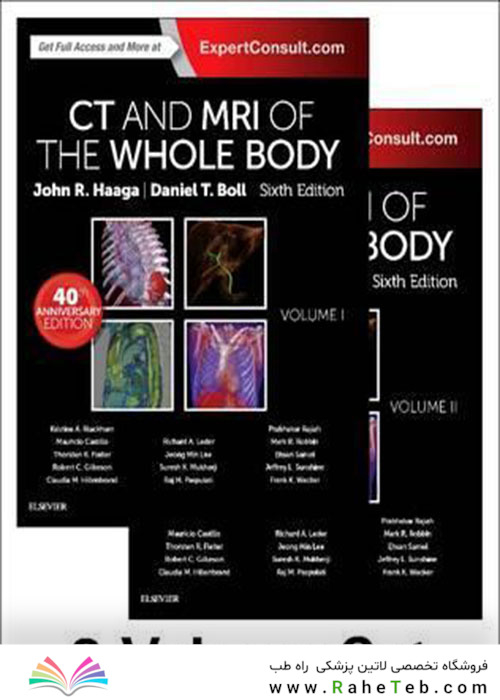 CT and MRI of the Whole Body, 2-Volume Set