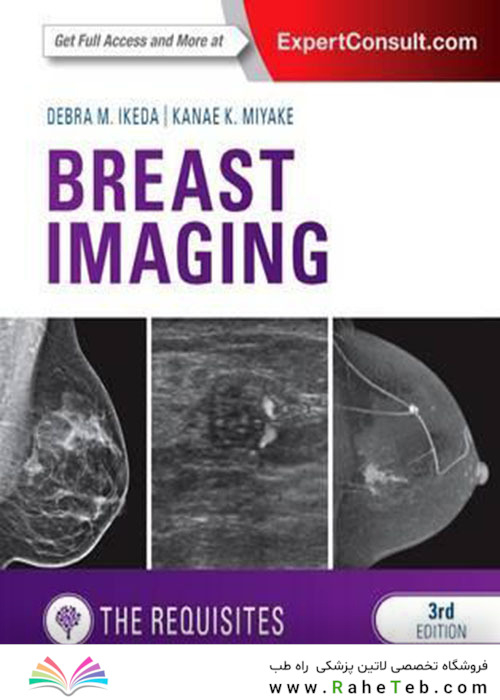Breast Imaging: The Requisites