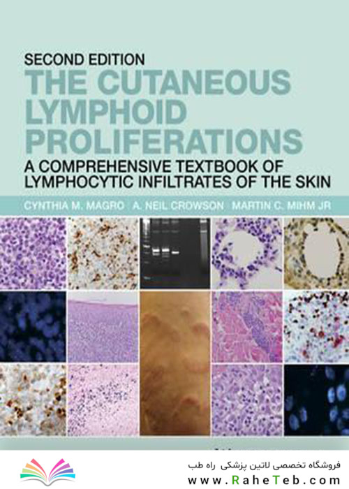 The Cutaneous Lymphoid Proliferations 