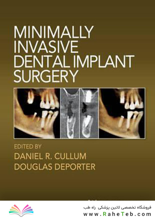 Minimally Invasive Dental Implant Surgery