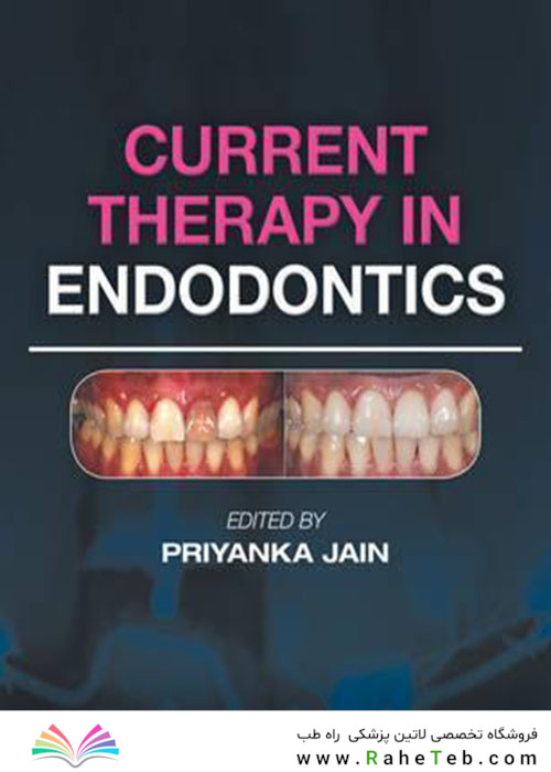 Current Therapy in Endodontics