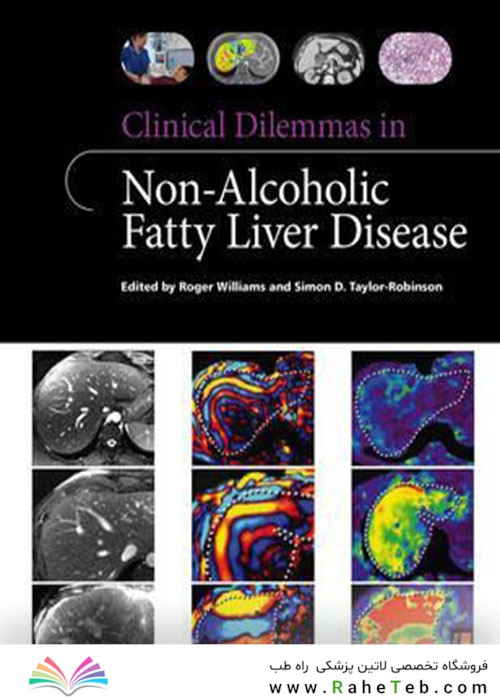 Clinical Dilemmas in Non-Alcoholic Fatty Liver Disease