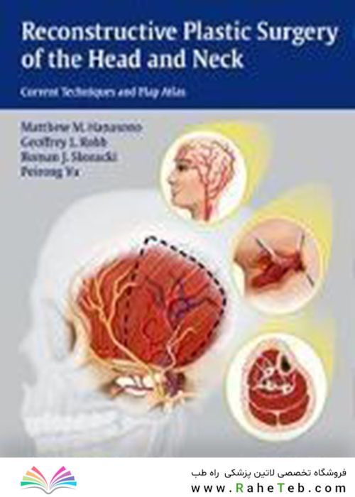 Reconstructive Plastic Surgery of the Head and Neck : Current Techniques and Flap Atlas